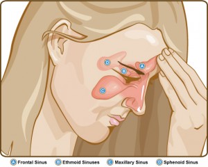 siddha medicine for sinus sinusitis and sinus infections